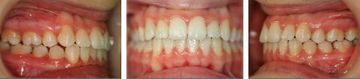 Clínica Dental Yarza ortodoncia 2