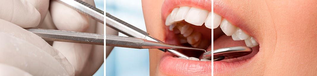 Clínica Dental Yarza persona en odontología