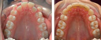 Clínica Dental Yarza ortodoncia 3