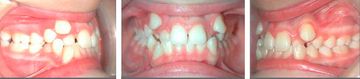 Clínica Dental Yarza ortodoncia 1