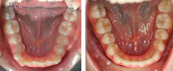 Clínica Dental Yarza ortodoncia 4